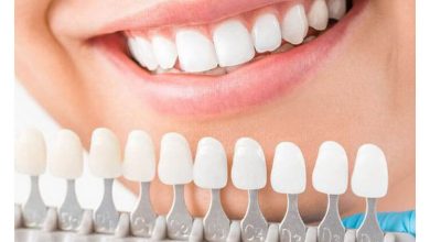 Whiten the Appearance of Old Crowns