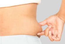 The Amazing Benefits of Liposuction Surgery for Fat Reduction